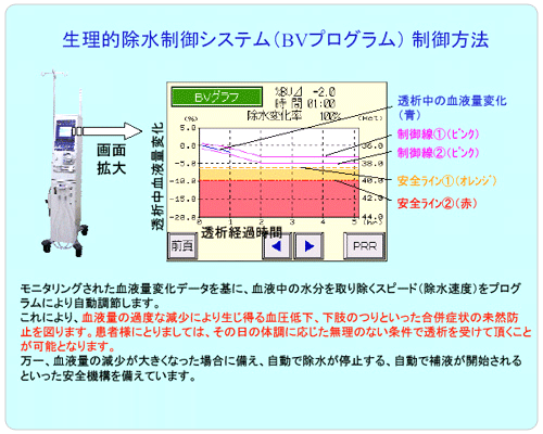 生理的除水制御システム（ＢＶプログラム）制御方法